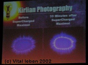 Kirlian Photo �ber die positive Wirkung von Maximol Solutions auf eine unserer K�rperzellen.